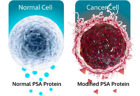 IsoPSA helps determine if elevated PSA came from cancer cells by analyzing the structure of the PSA protein.